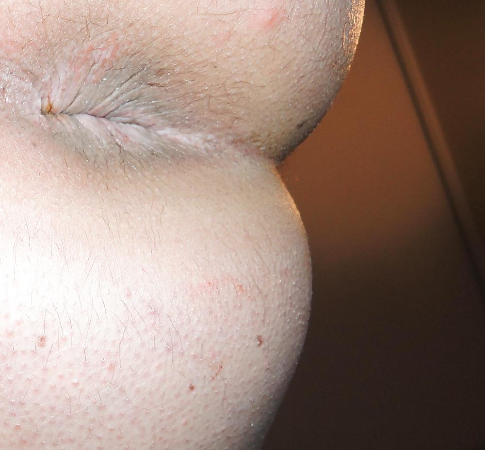 15P Some butthole when I was 19 yo girlie