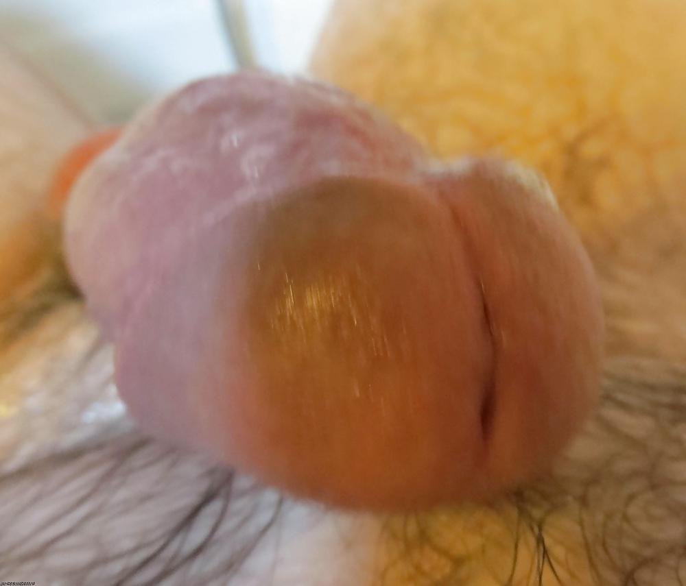 25P Cock penis boner