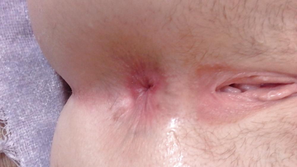 6P Shaving her hairy ass