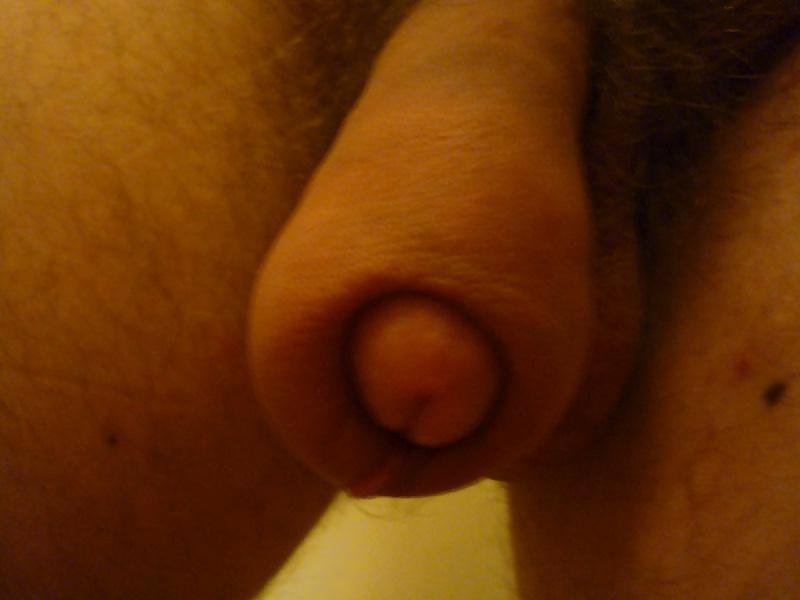 6P My ugly penis