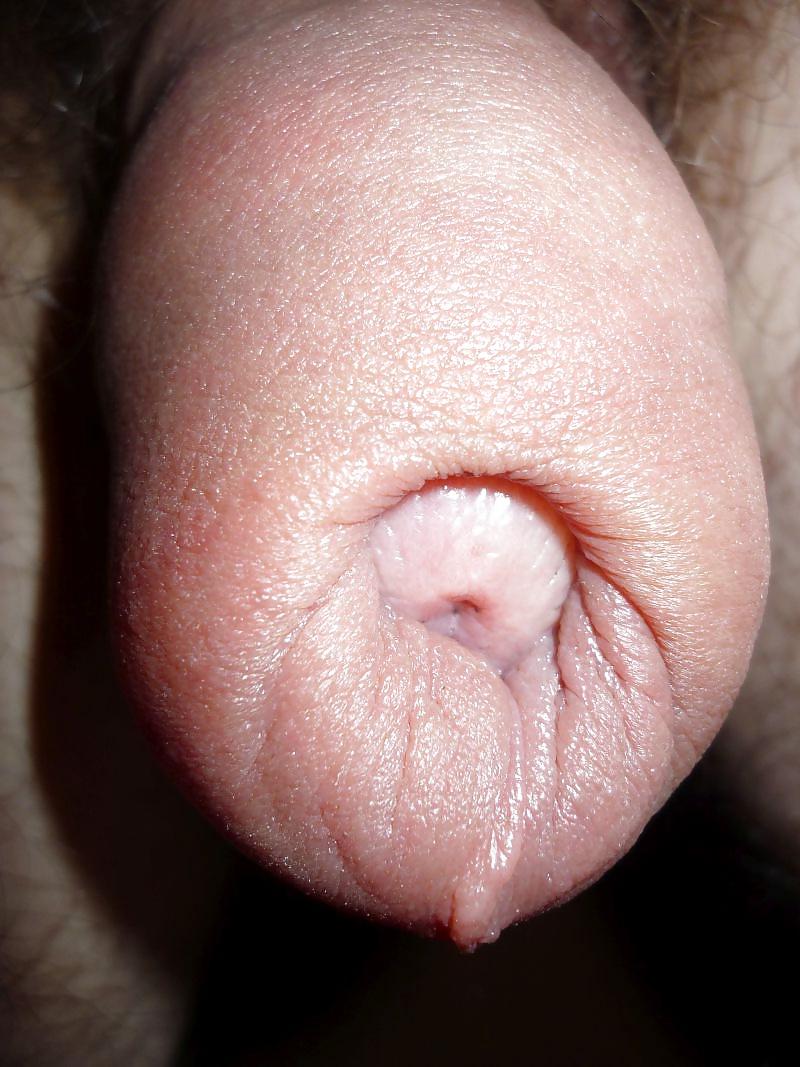 6P My ugly penis