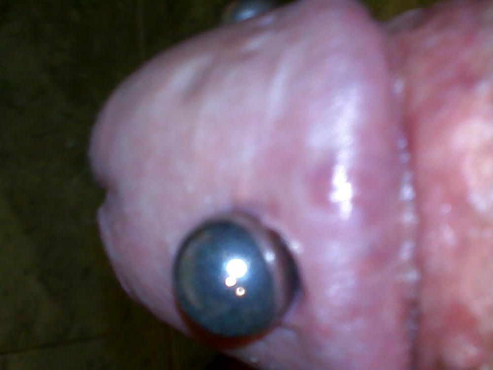 10P Penis saline injection 1