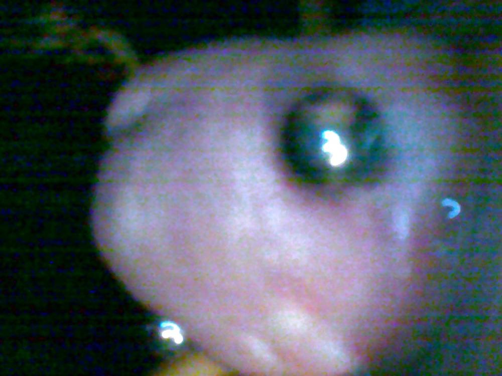 10P Penis saline injection 1