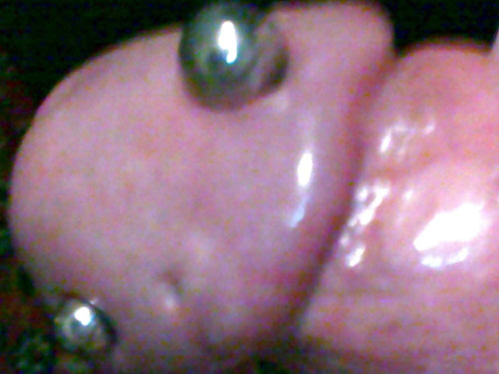 10P Penis saline injection 1