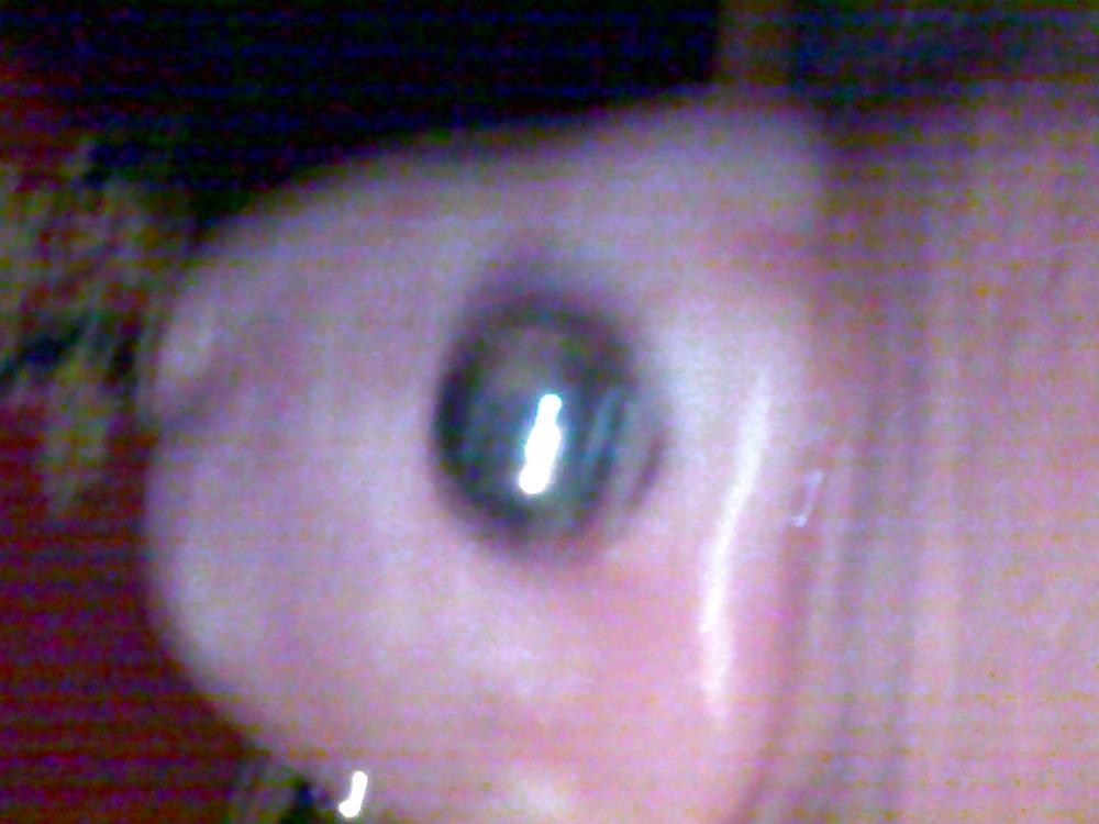 10P Penis saline injection 1