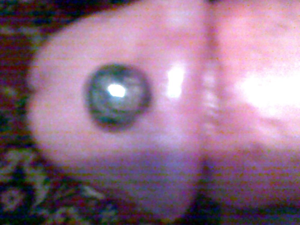 10P Penis saline injection 1