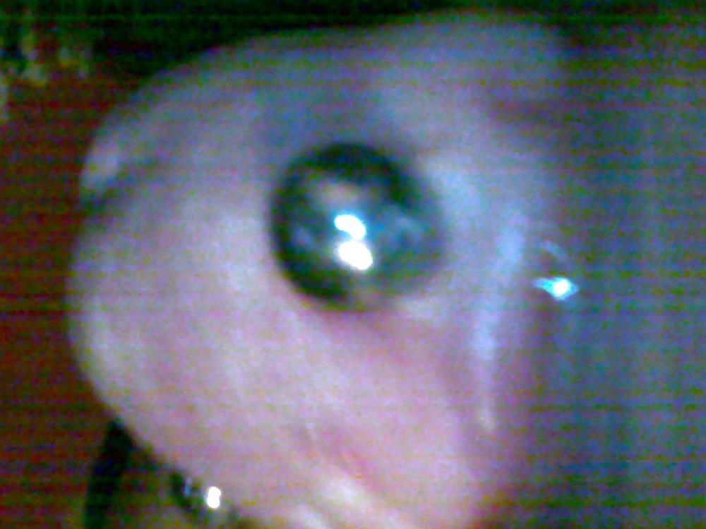 10P Penis saline injection 1