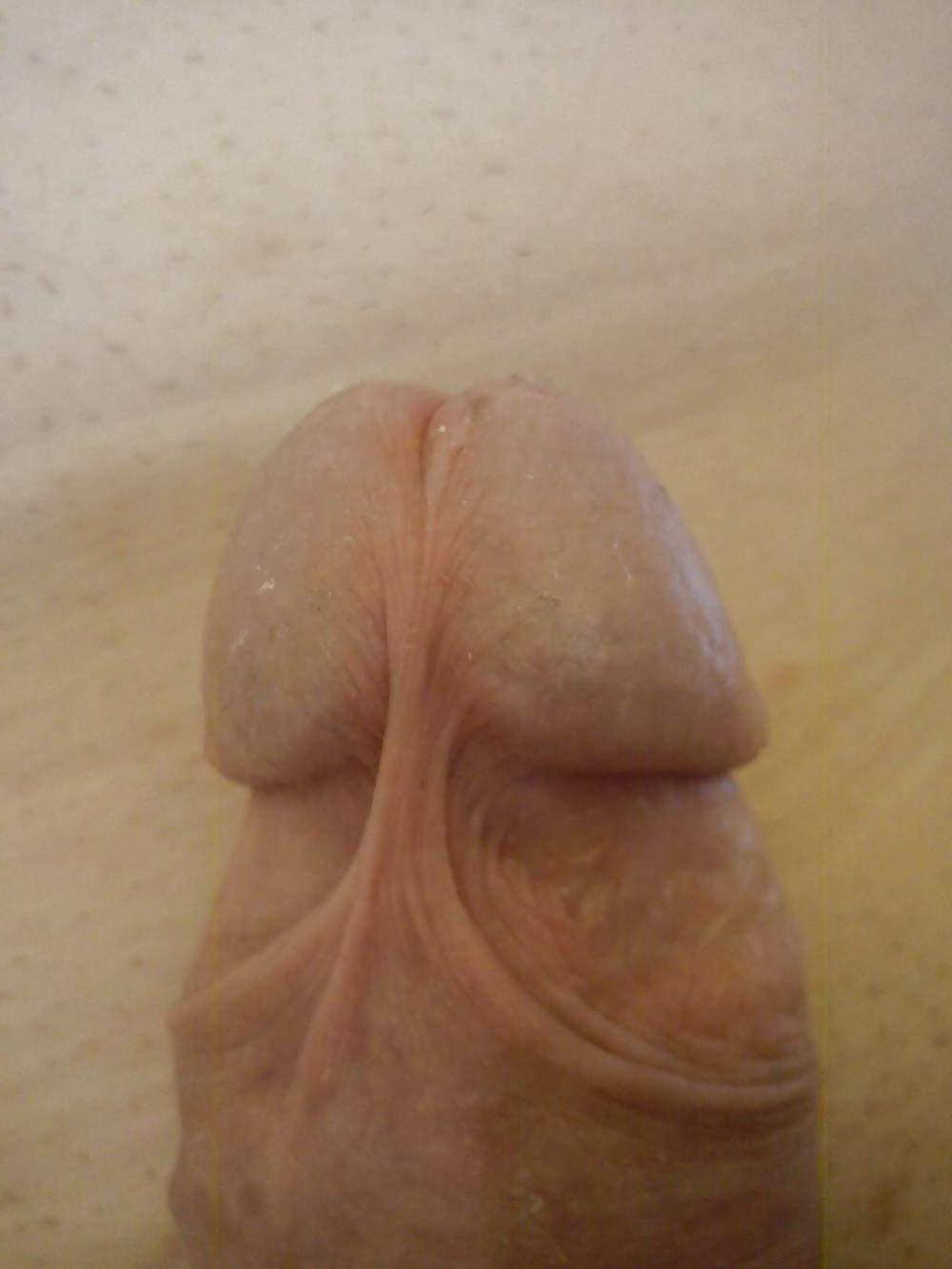 18P My penis