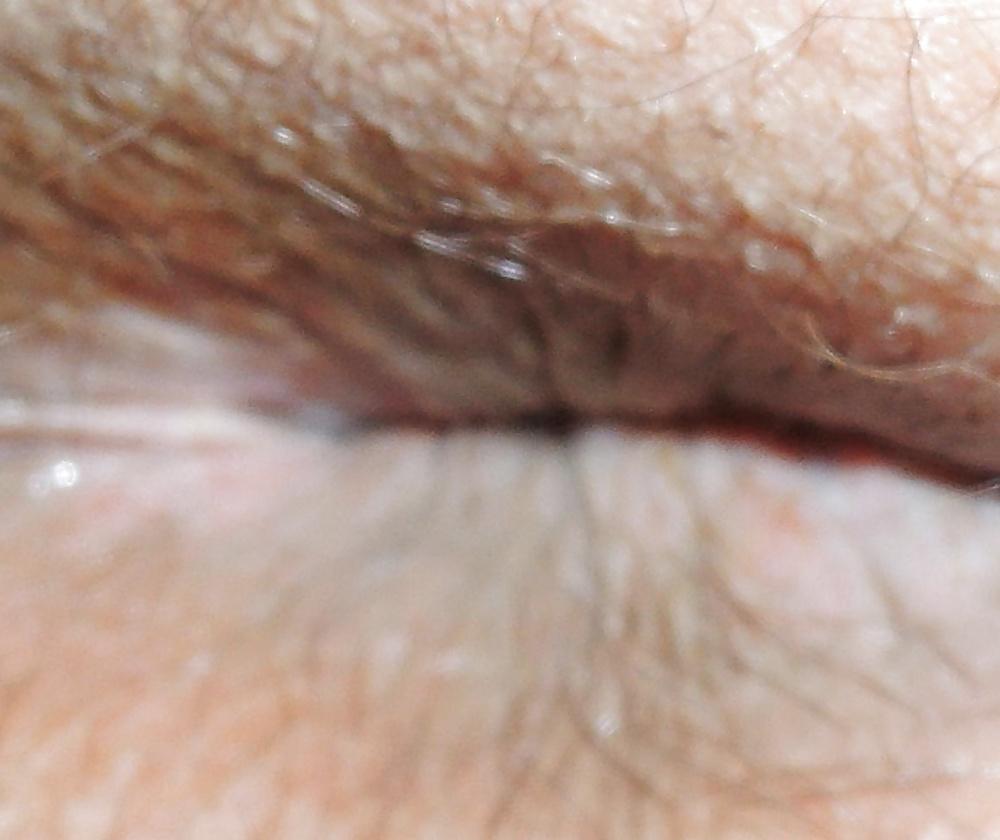 11P My easter butthole