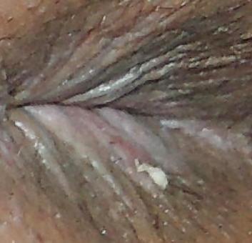 11P My easter butthole