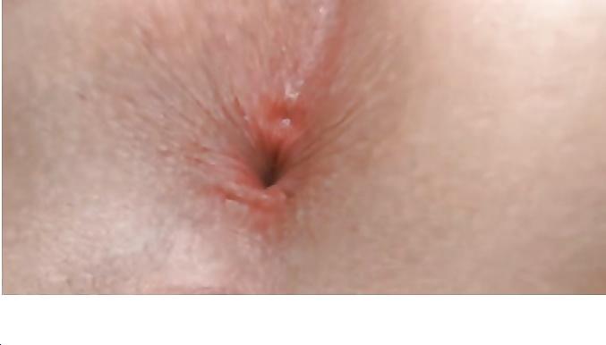 17P Clean gaped butthole
