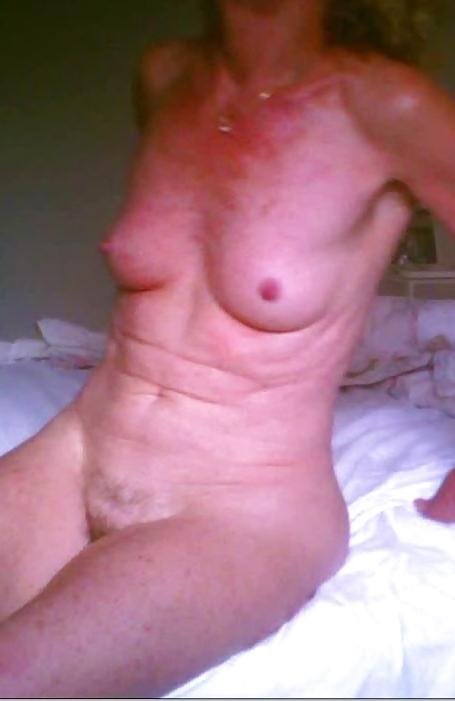 9P The Other nurse : front side only
