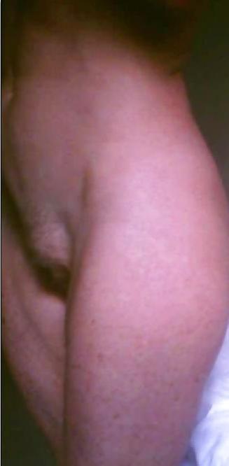 9P The Other nurse : front side only