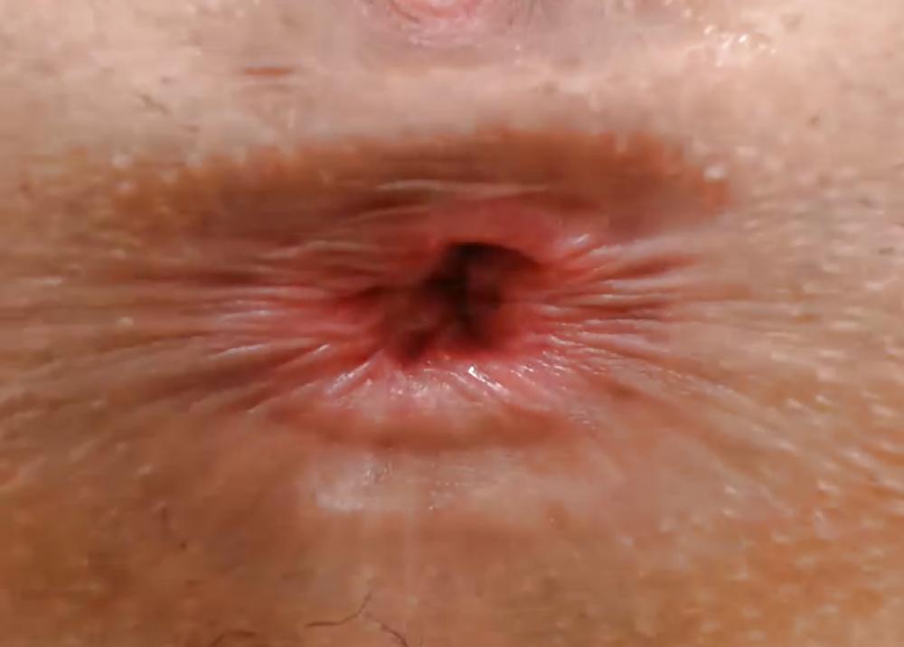 16P Open Asshole
