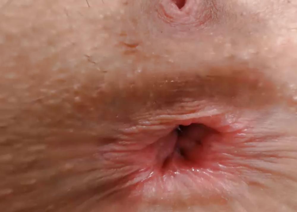 16P Open Asshole