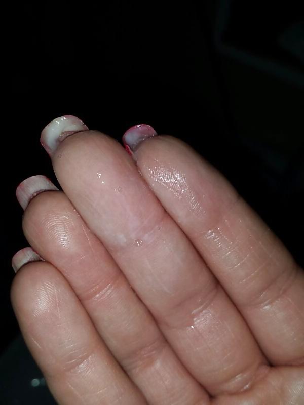 5P Natural red hand nails