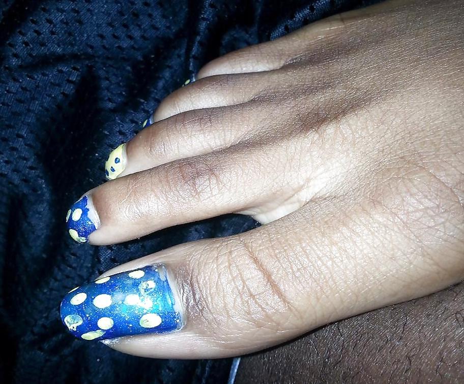 18P Long toenails
