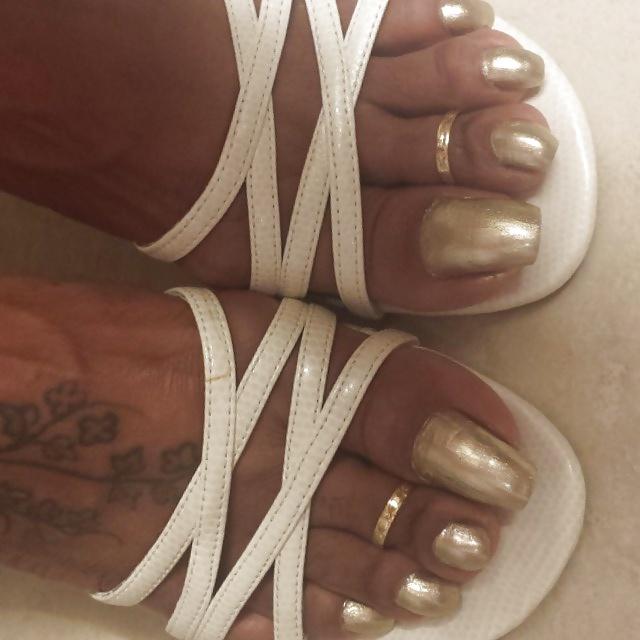 18P Long toenails