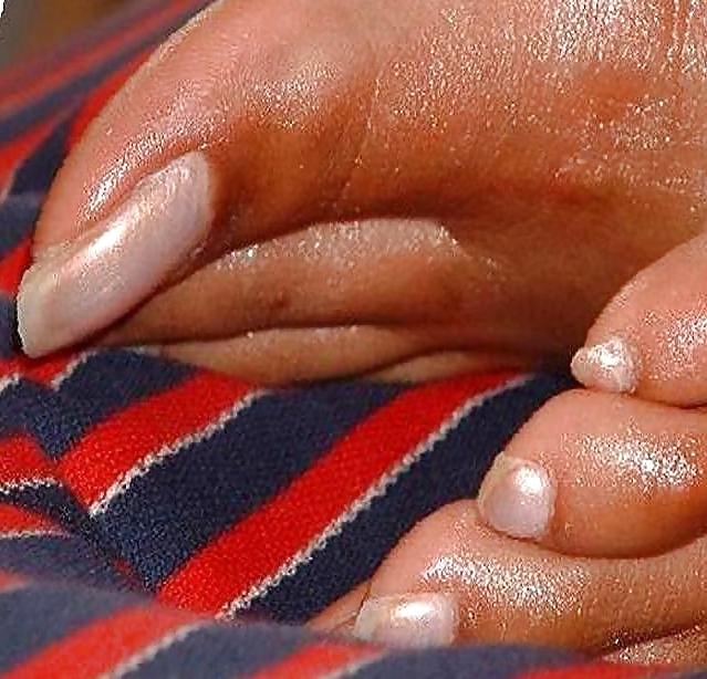 18P Long toenails