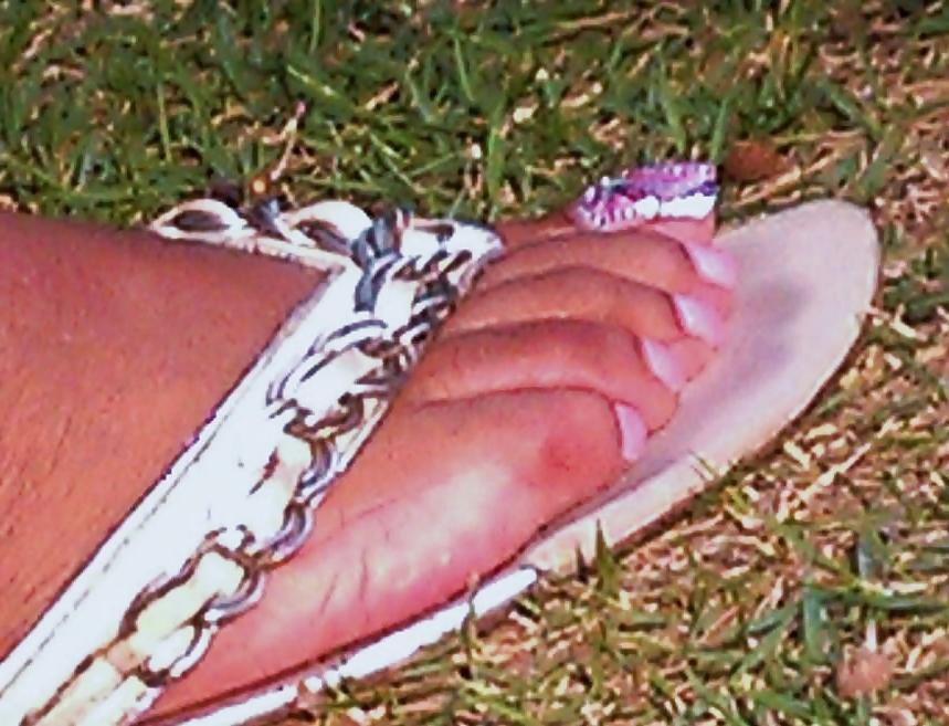 18P Long toenails