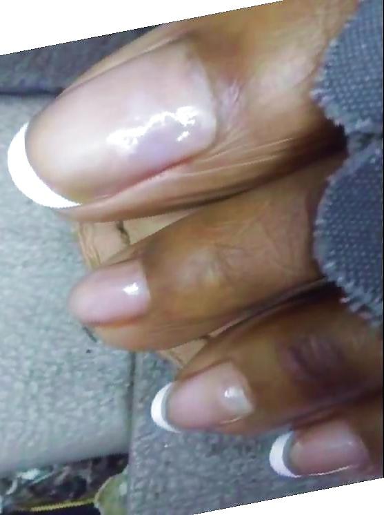 18P Long toenails