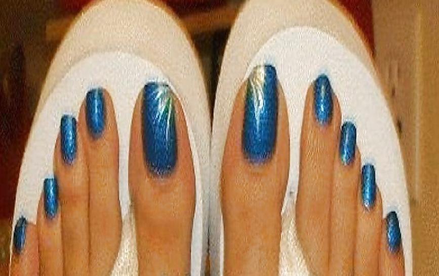 18P Long toenails