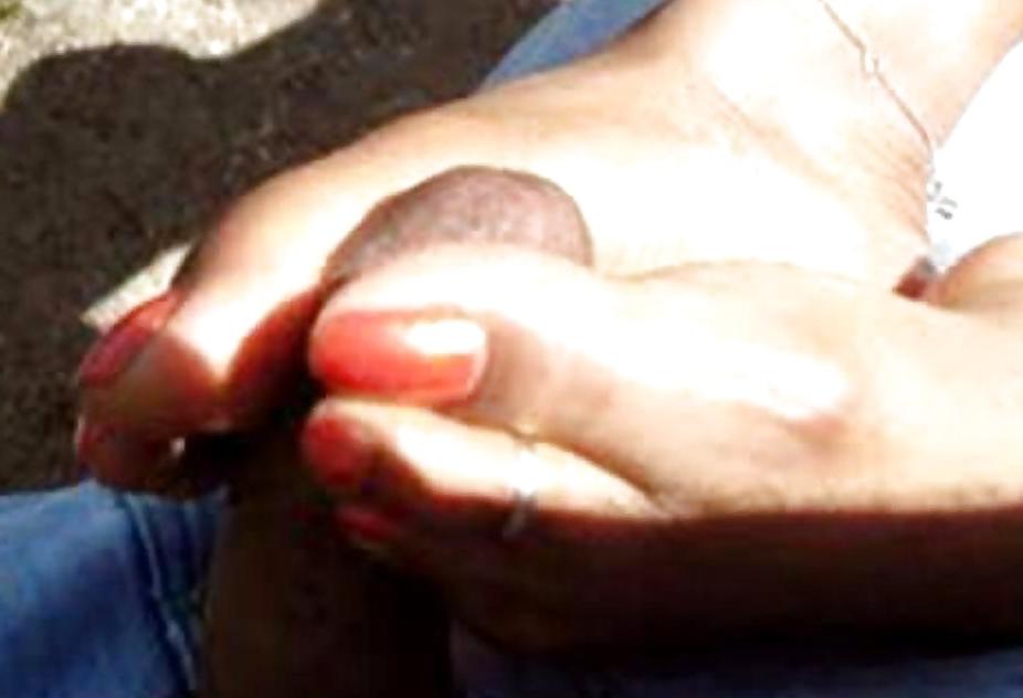 18P Long toenails
