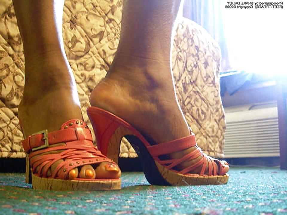 18P Long toenails