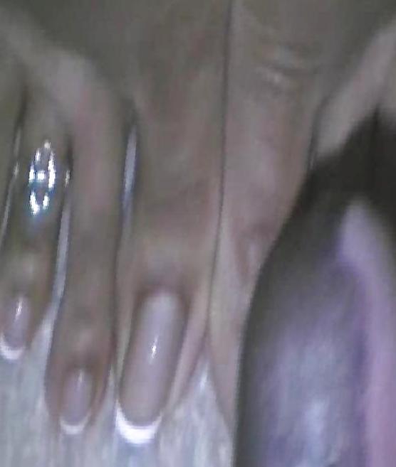 18P Long toenails
