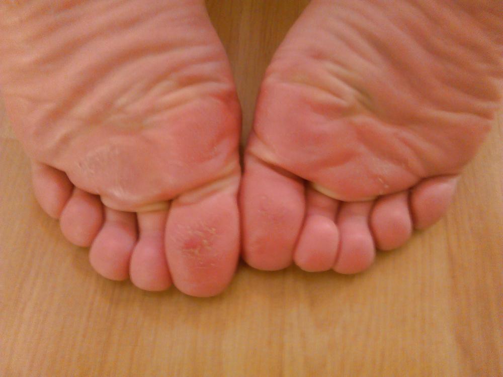7P FEET ON HOLIDAY 3