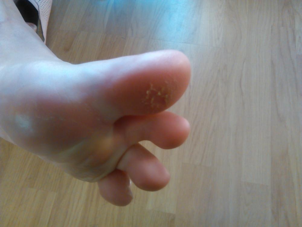 7P FEET ON HOLIDAY 3