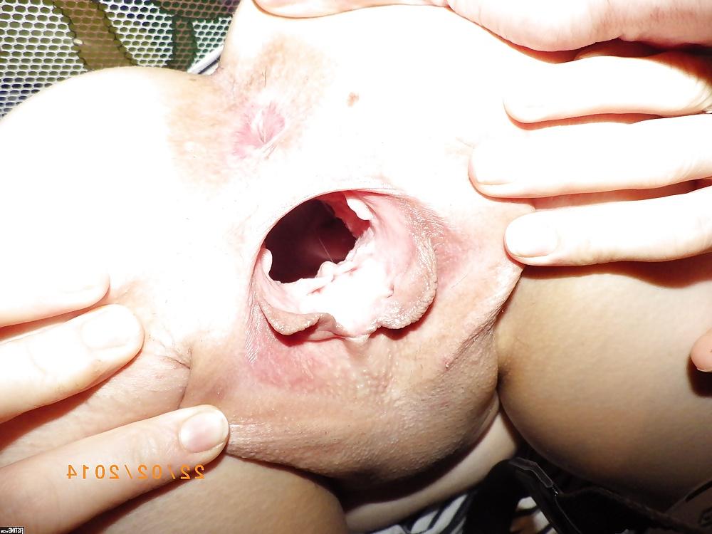 16P Gaping pussy and asshole