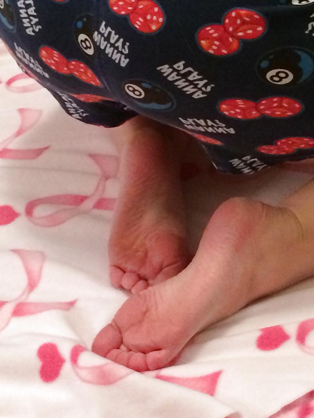 5P Soles needing some lotion...