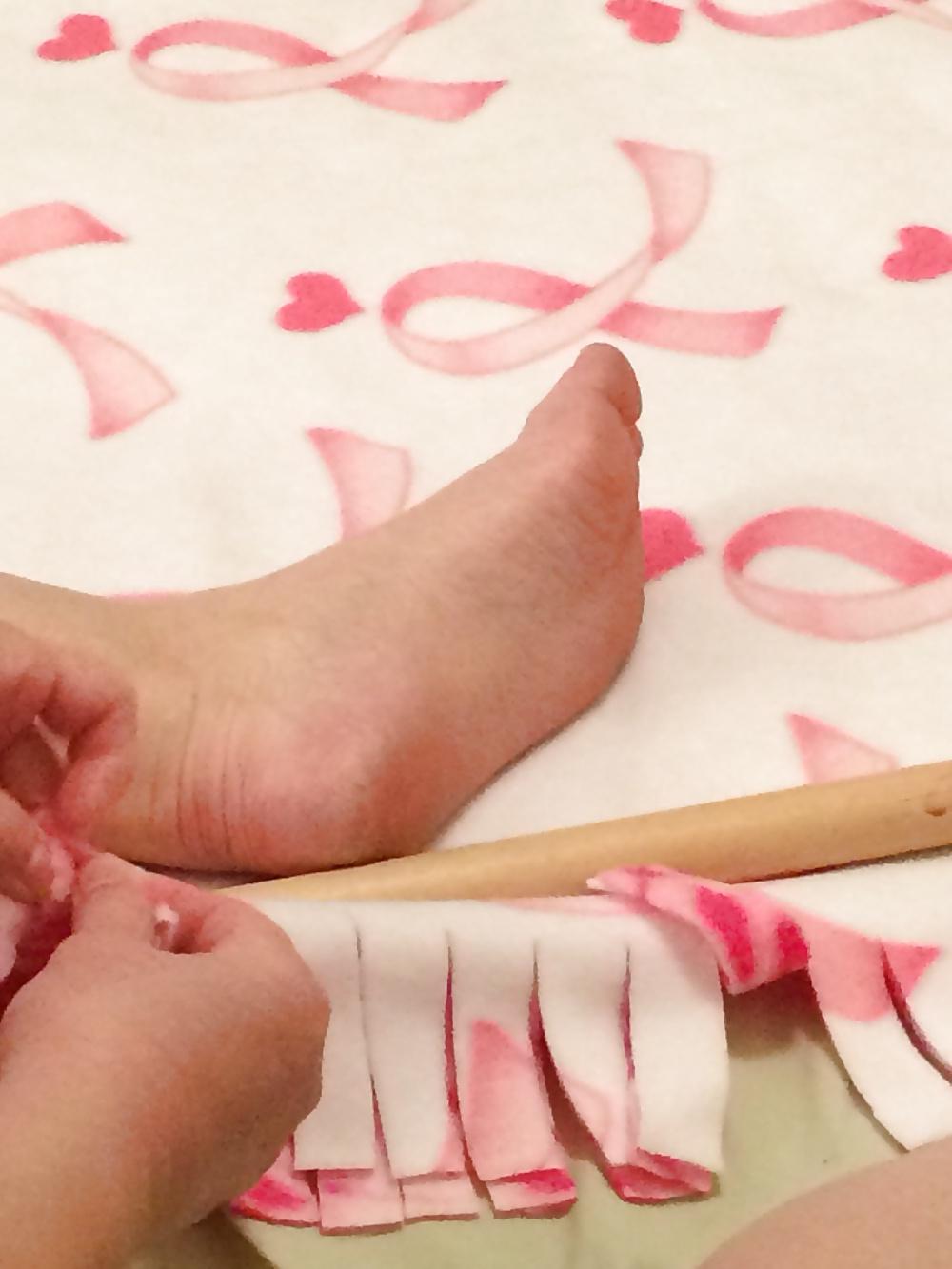 5P Soles needing some lotion...