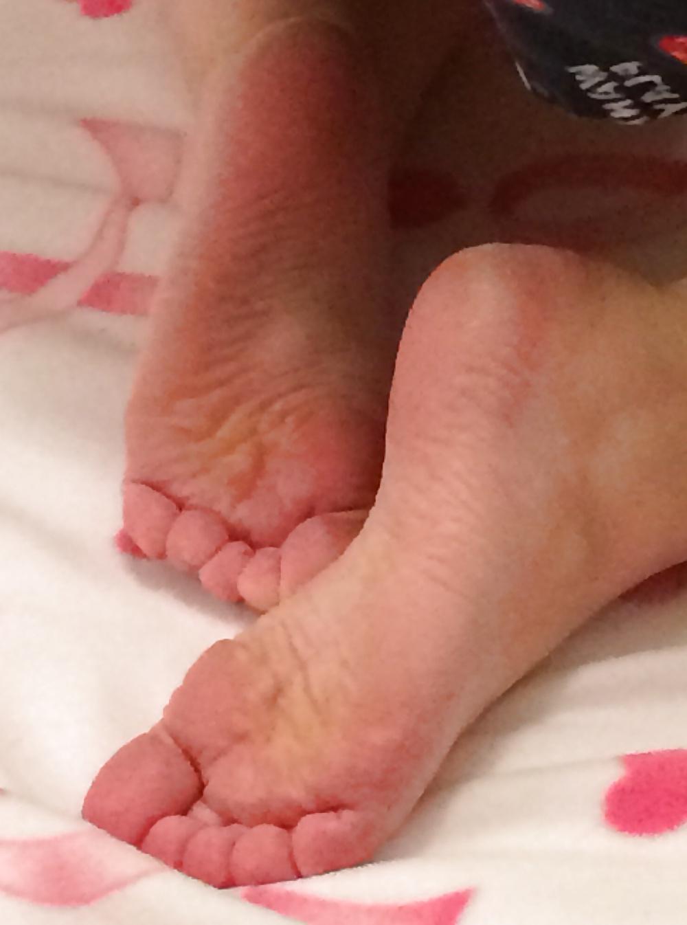 5P Soles needing some lotion...