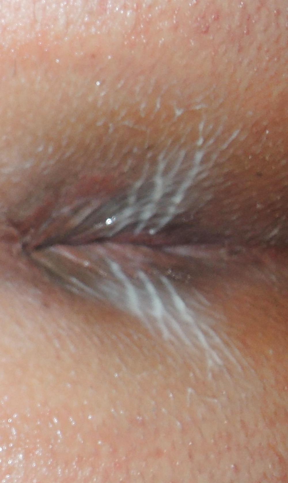 14P Misch pussy and butthole