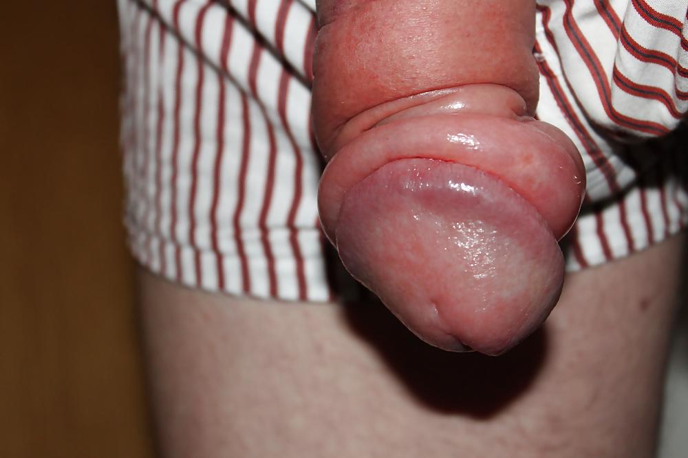 25P Penis Pumpe ,geil.