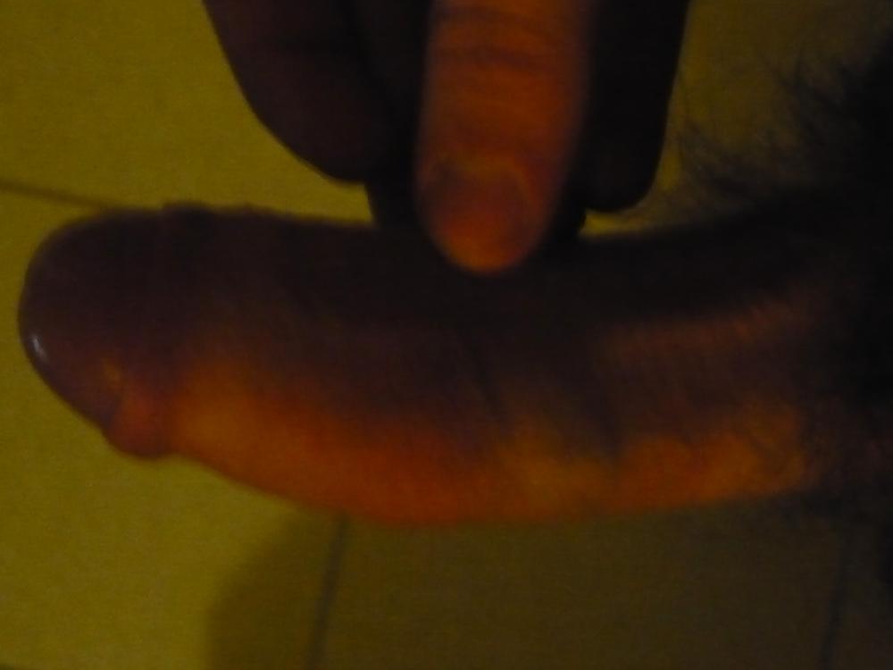 7P My penis 2