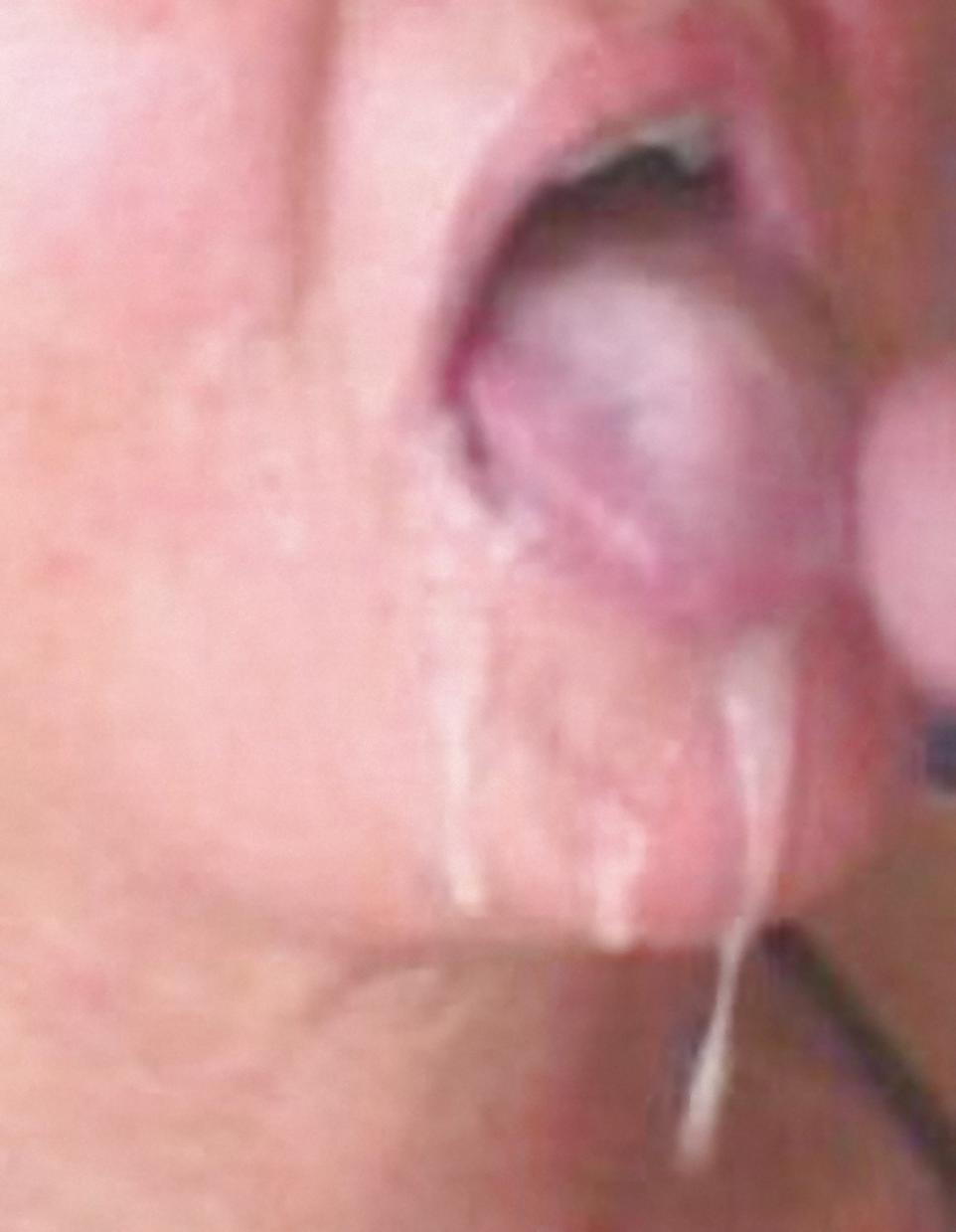 10P DOTTORESSA - MILF DOCTOR  - MOUTH PANTIES FILLED IN CUM