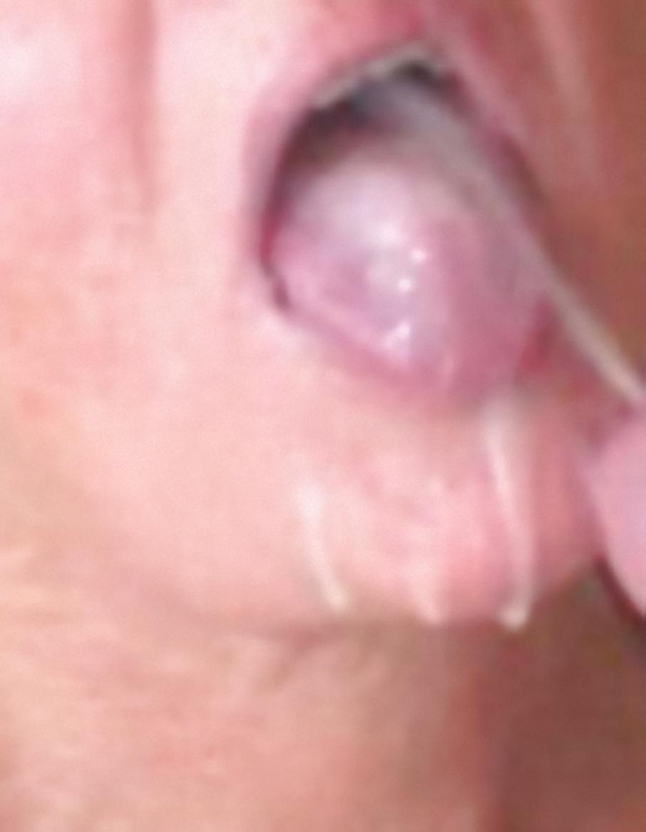 10P DOTTORESSA - MILF DOCTOR  - MOUTH PANTIES FILLED IN CUM