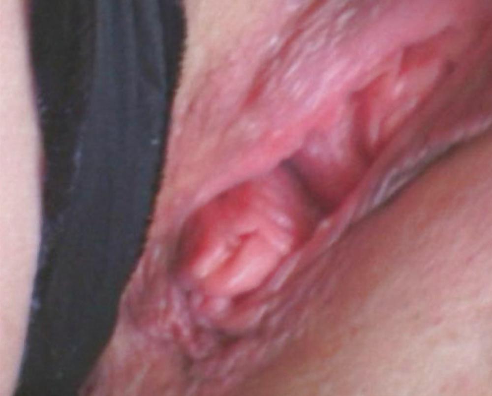 10P DOTTORESSA - MILF DOCTOR  - MOUTH PANTIES FILLED IN CUM