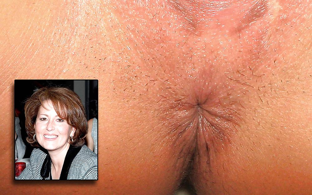 25P MATURE ASSHOLE
