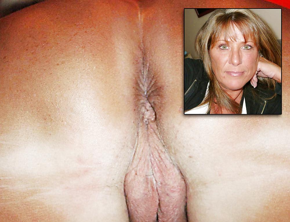 25P MATURE ASSHOLE