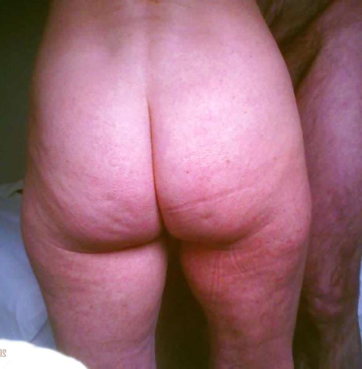 11P The other mature nurse of the ward mixed pics