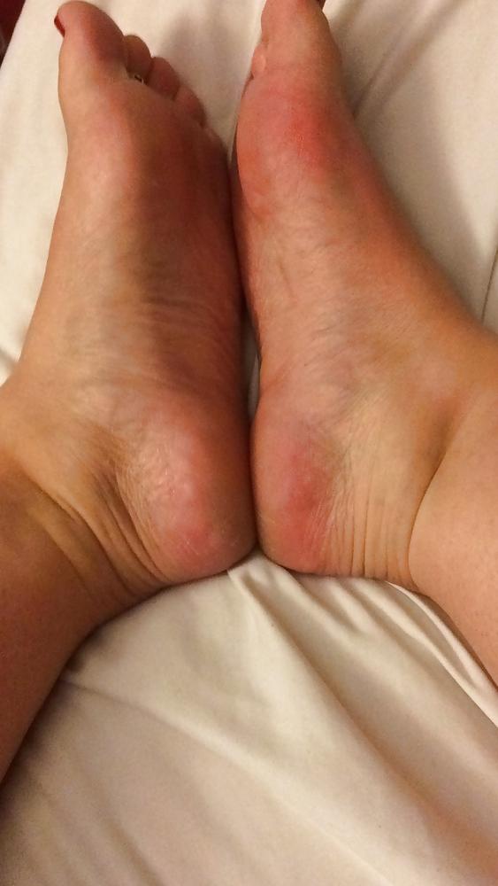 18P BBW Friend's Amature Wrinkly Soles