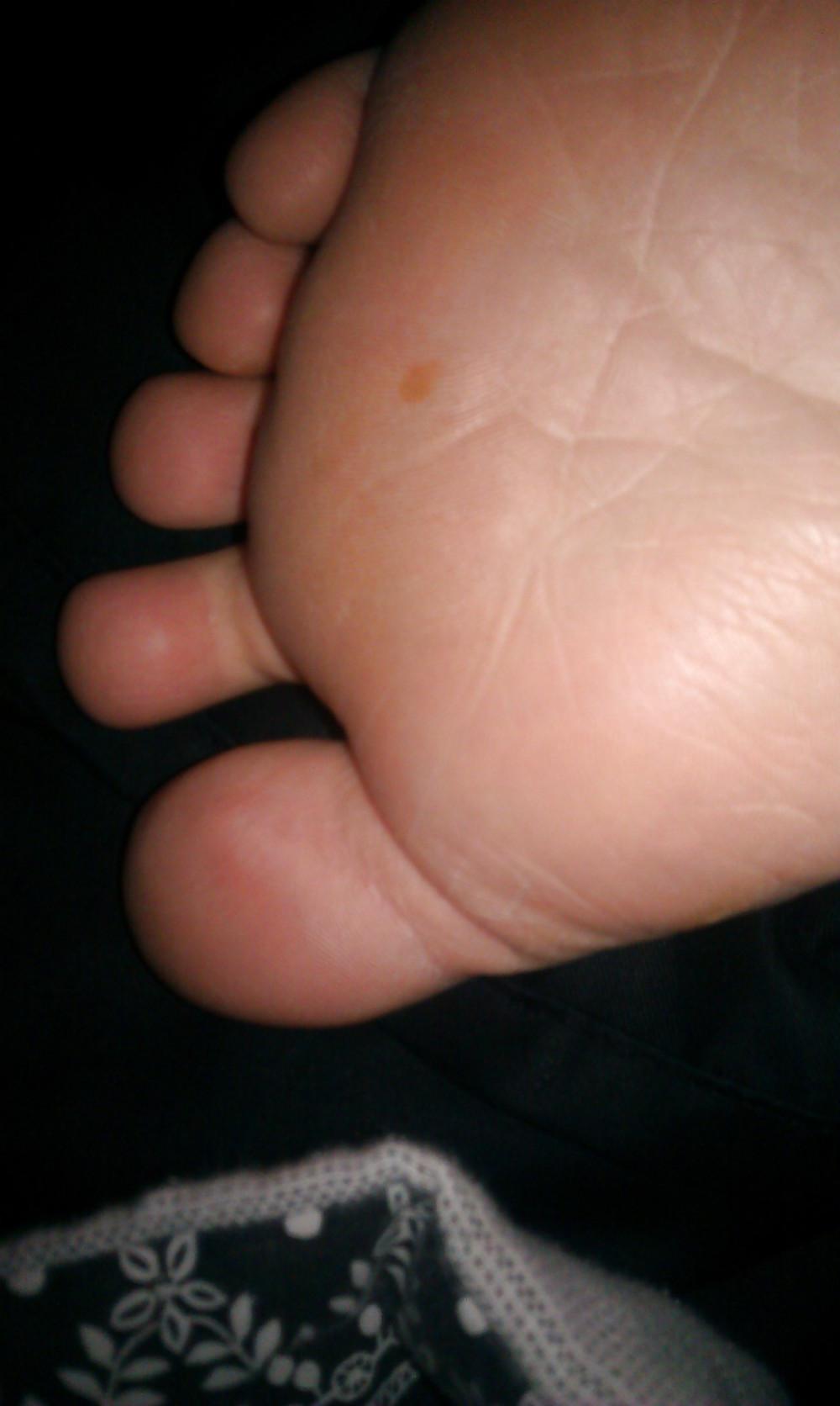 11P Feet feet an more feet