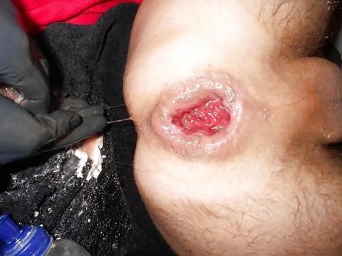 9P Asshole anal extreme rosebud gape prolaps 