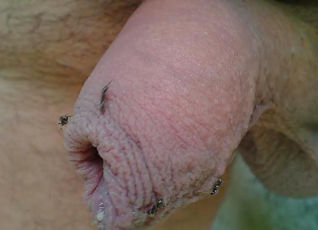 20P Ants on my penis