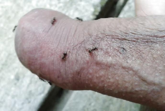 20P Ants on my penis
