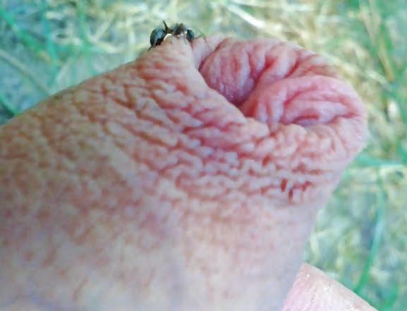 20P Ants on my penis